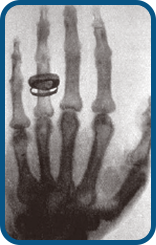 X-ray image