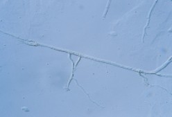 圖五a 　無隔膜菌絲