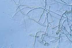 圖五b 　有隔膜菌絲