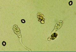 圖六　不同型式的子囊菌