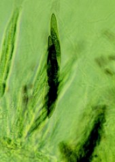 圖六　不同型式的子囊菌