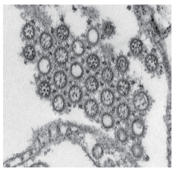 圖二 H1N1 A型流感病毒」的穿透式電子顯微鏡(TEM)構